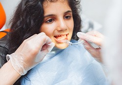 Dentist putting clear aligner on teenage girl