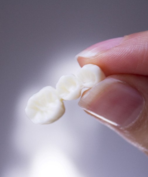 woman holding a dental bridge