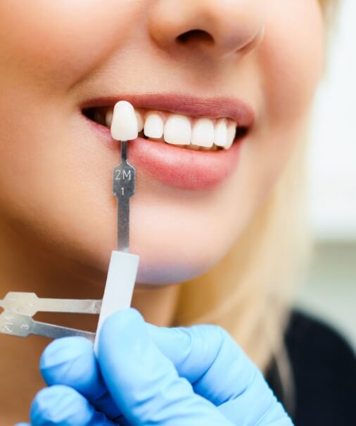 Smile compared with color option for metal free dental crowns