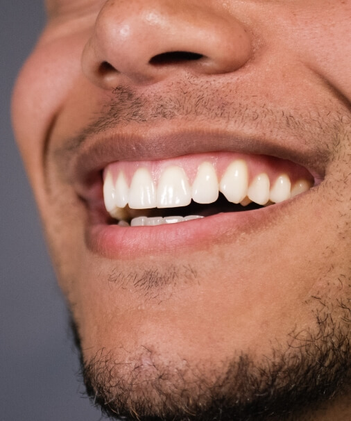 Closeup of flawless smile after gum recontouring