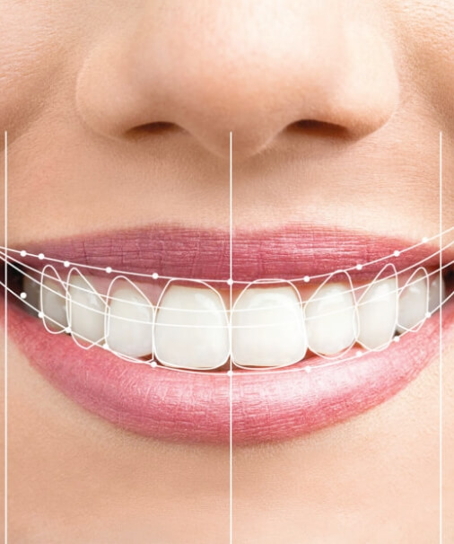 Virtual smile design system treatment plan over patient's smile