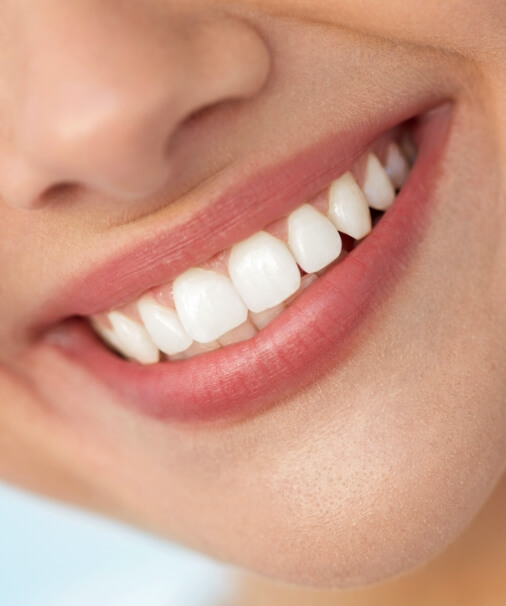 Closeup of flawless smile after full mouth reconstruction