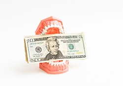 Money in a set of model teeth