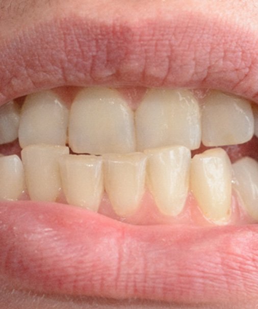 A close-up of a man’s crooked smile 