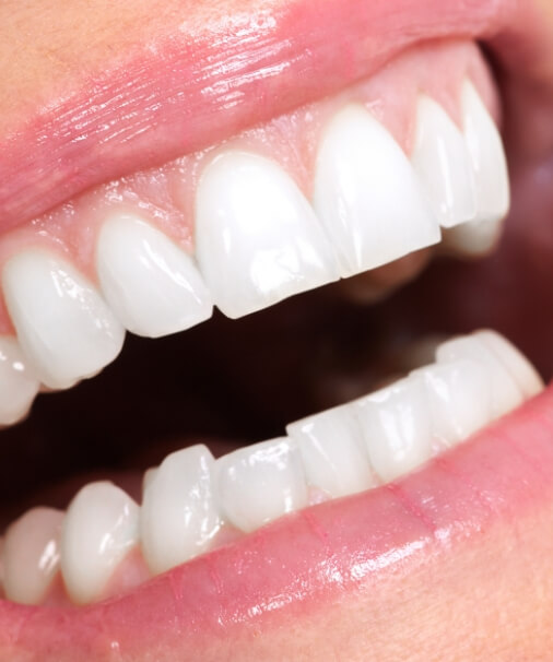Closeup of smile with healthy gums