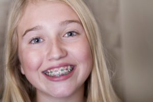 A girl smiling with metal braces.