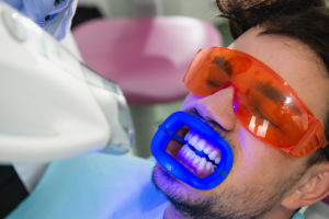 Man receiving Zoom ! teeth whitening