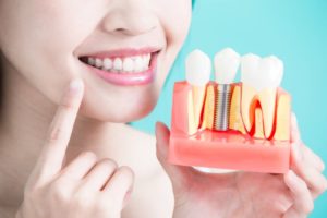 Smiling person holding implants